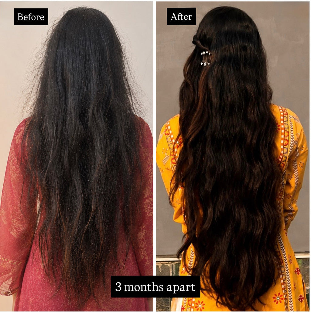 Anti Hairfall Treatment Oil – 100ml