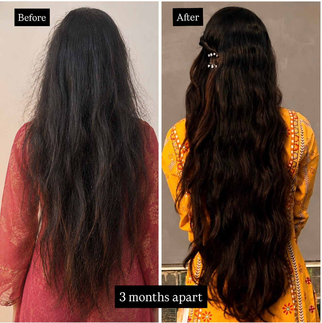 Anti Hairfall Treatment Oil – 100ml