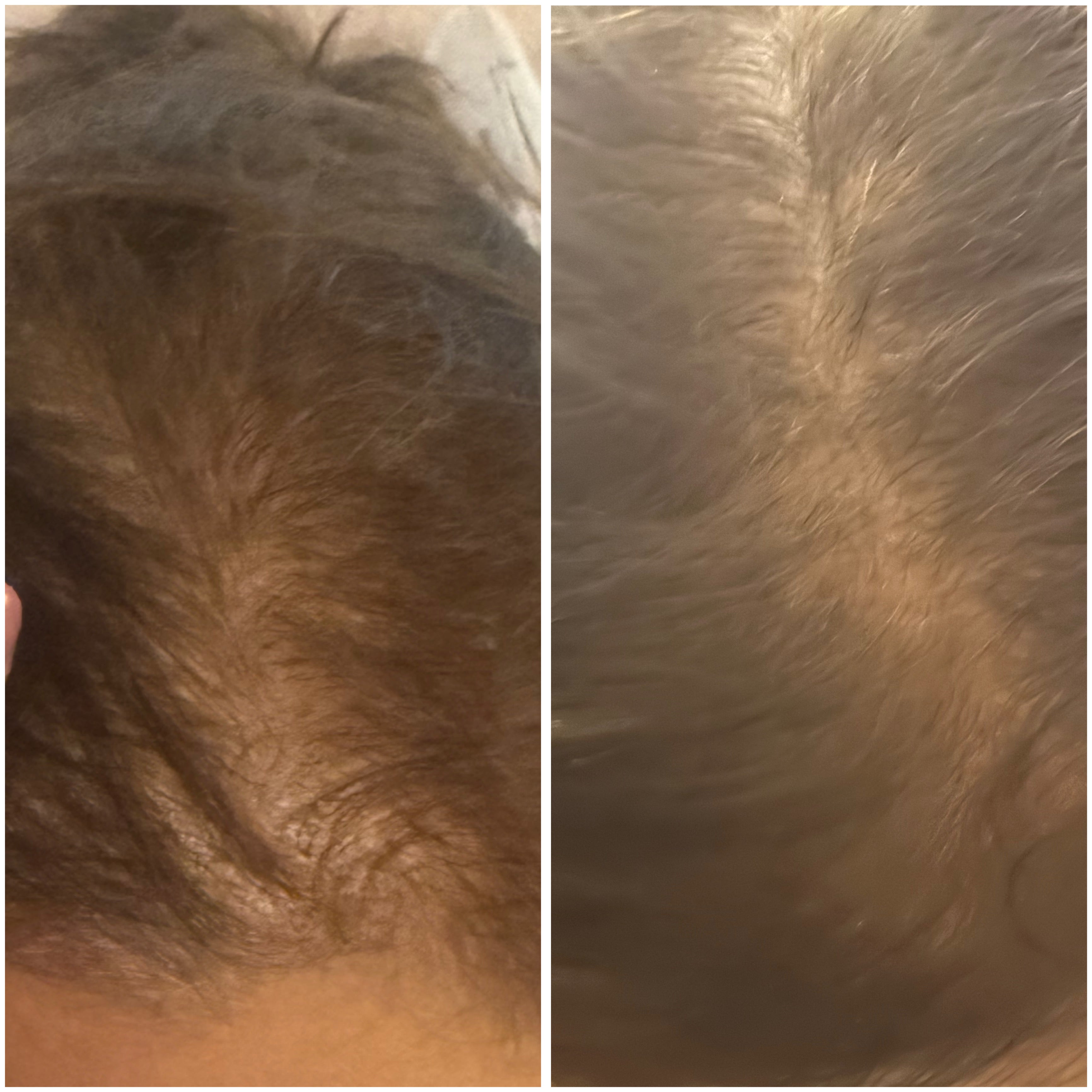Anti Hairfall Treatment Oil – 100ml