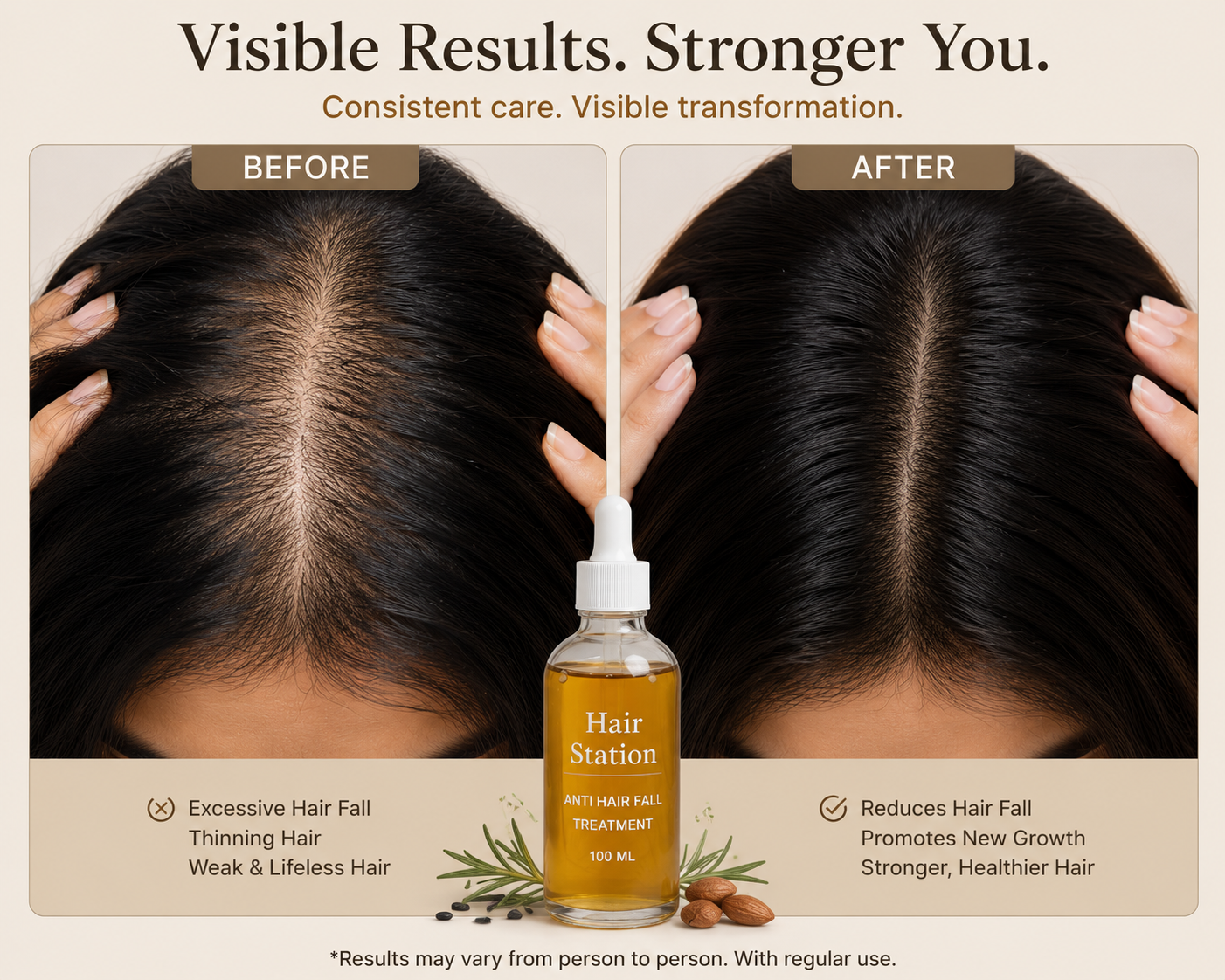 Anti Hairfall Treatment Oil – 100ml